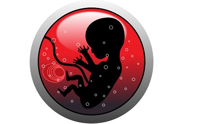 مایع آمنیوتیک