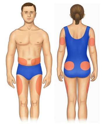دوز تزریقی آمپول اچ سی جی دوز تزریقی آمپول اچ سی جی