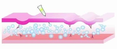 کربوکسی تراپی