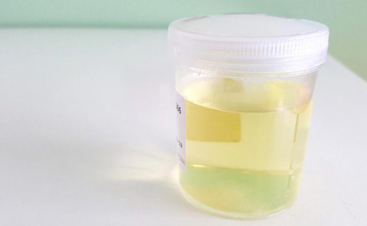 نحوه انجام تست بارداری با خمیردندان نحوه انجام تست بارداری با خمیردندان