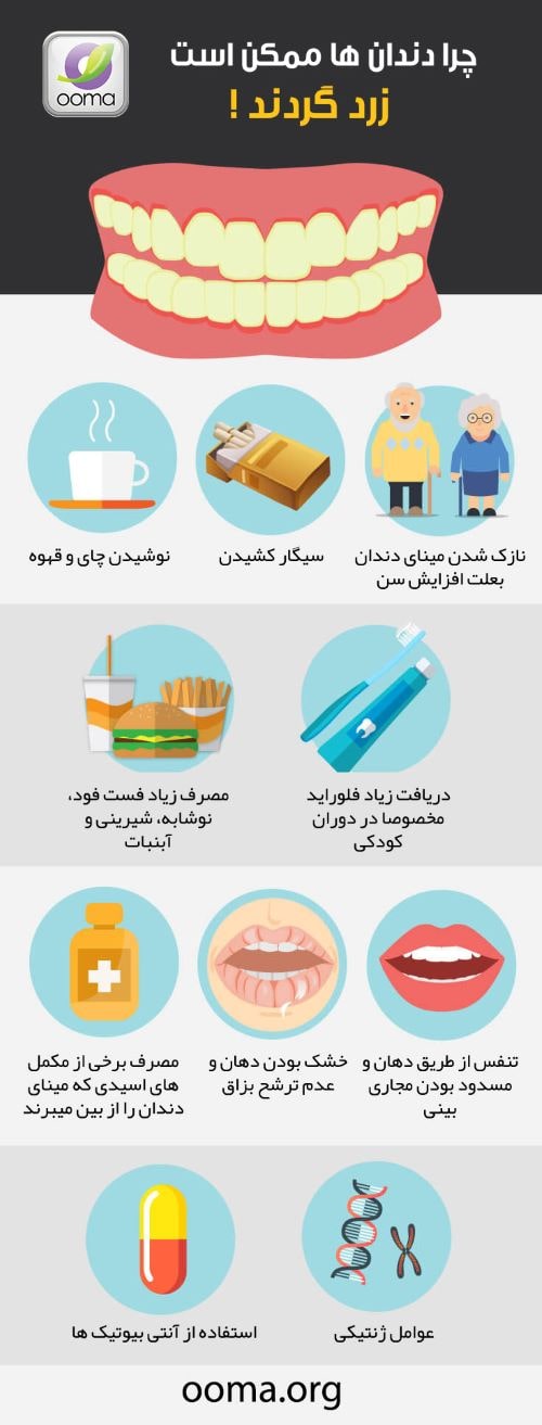 علت زرد شدن دندان ها