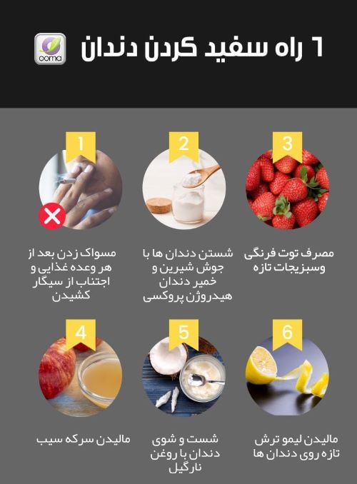 راه سفید کردن دندان