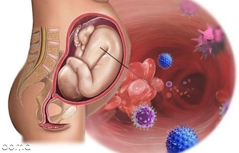 زایمان طبیعی با زگیل تناسلی زایمان طبیعی با زگیل تناسلی