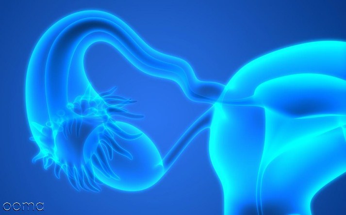 انسداد لوله رحمی