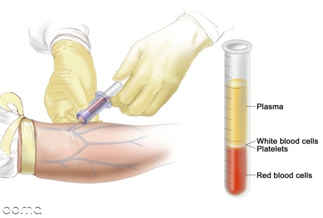 خواندن جواب آزمایش خون خواندن جواب آزمایش خون