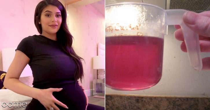 تعیین جنسیت با کلم قرمز