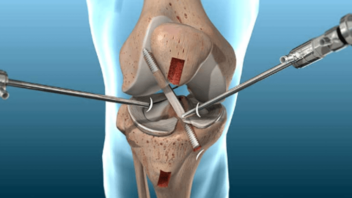 وظیفه متخصص ارتوپدی وظیفه متخصص ارتوپدی