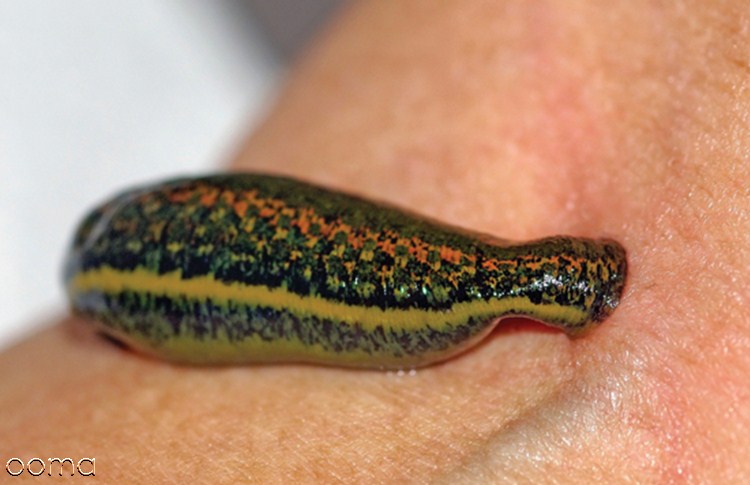 زالو درمانی زالو درمانی