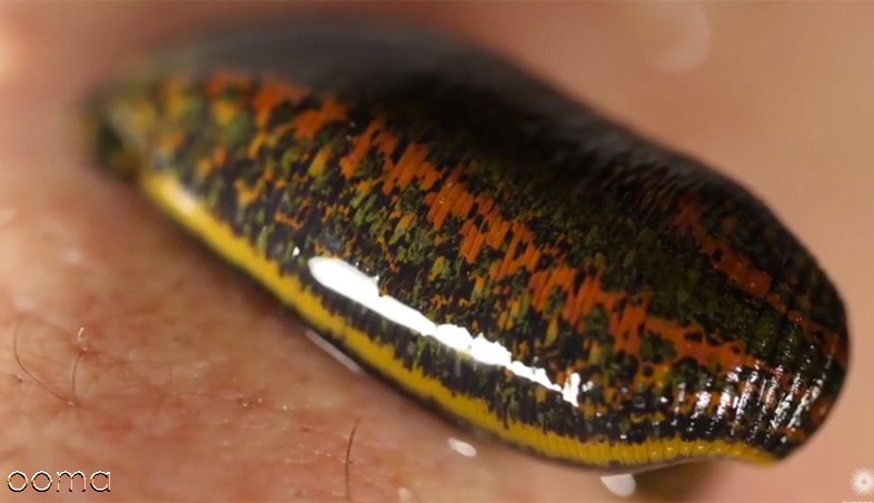 فواید زالو درمانی فواید زالو درمانی