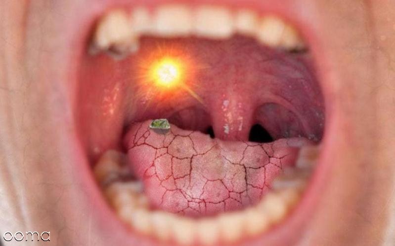 دلایل تلخی دهان