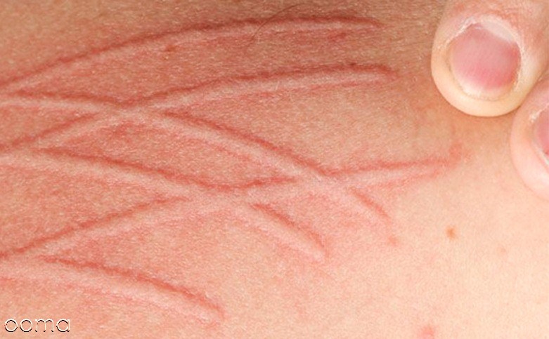 علت های خارش بدن علت های خارش بدن