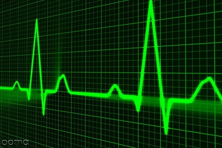 علائم ضربان قلب بالا