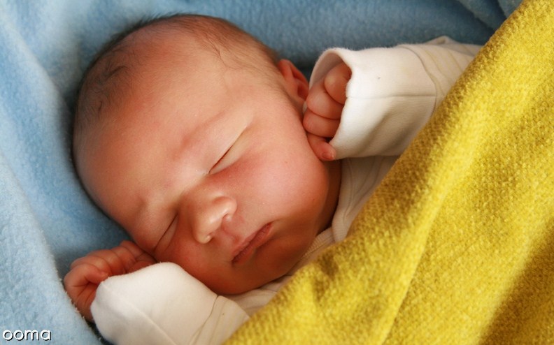 زردی نوزاد زردی نوزاد