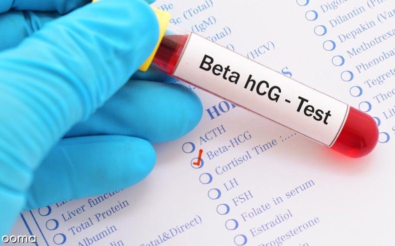 آیا آزمایش خون دقیق است آیا آزمایش خون دقیق است؟