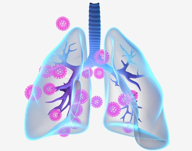 علائم عفونت ریه