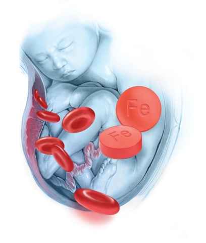 قرص آهن در بارداری قرص آهن در بارداری