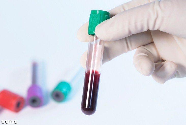 رنج نرمال پلاکت خون در بارداری رنج نرمال پلاکت خون در بارداری