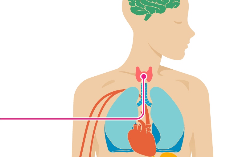 عوارض کم کاری تیروئید چیست عوارض کم کاری تیروئید چیست