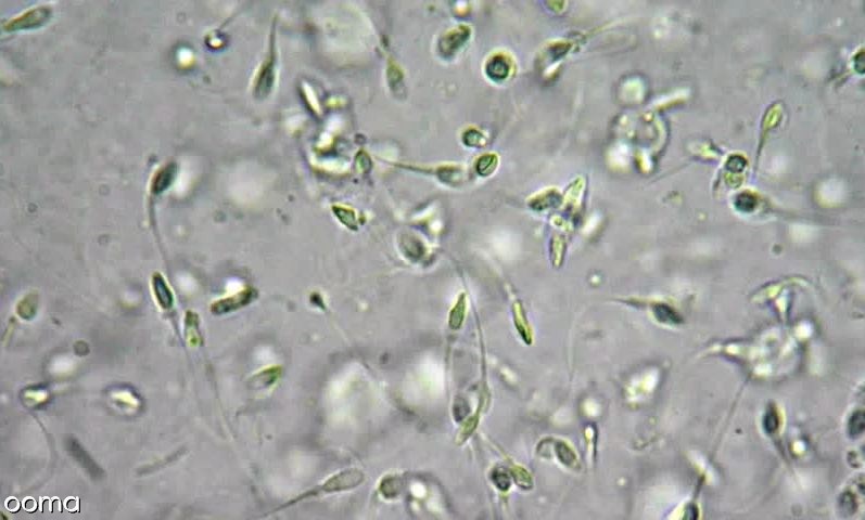 تفسیر تست pct