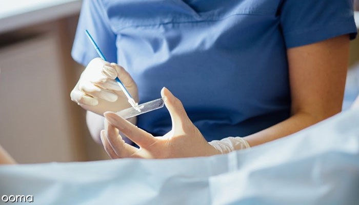 7943-تست-پاپ-اسمیر