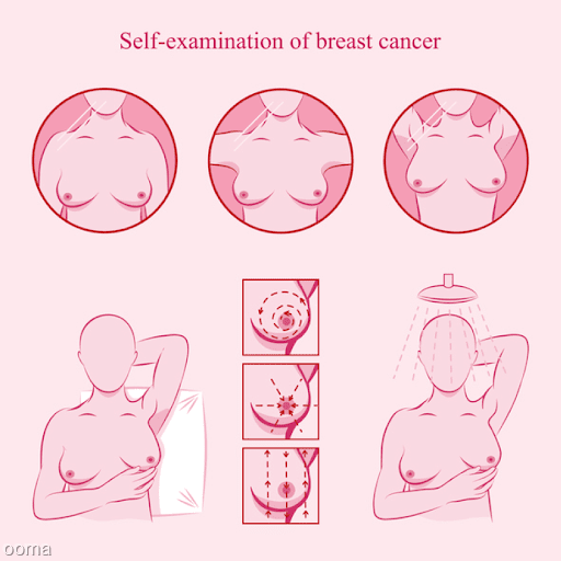 تشخیص سرطان سینه در منزل