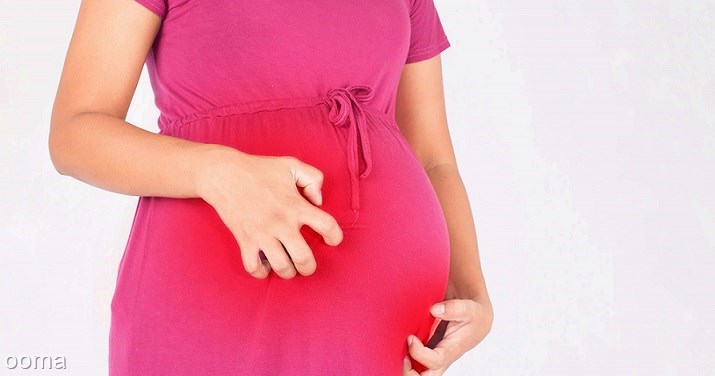 هیدروکورتیزون در بارداری هیدروکورتیزون در بارداری