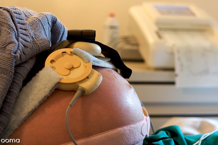 تست استرسی انقباضی