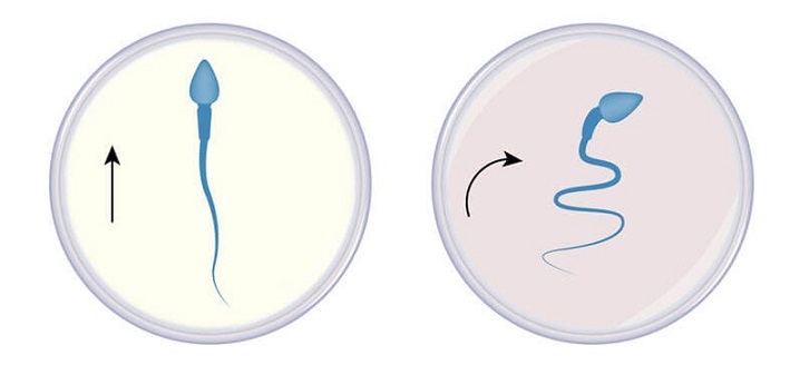 سرعت حرکت اسپرم