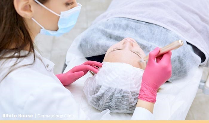 مزونیدلینگ صورت