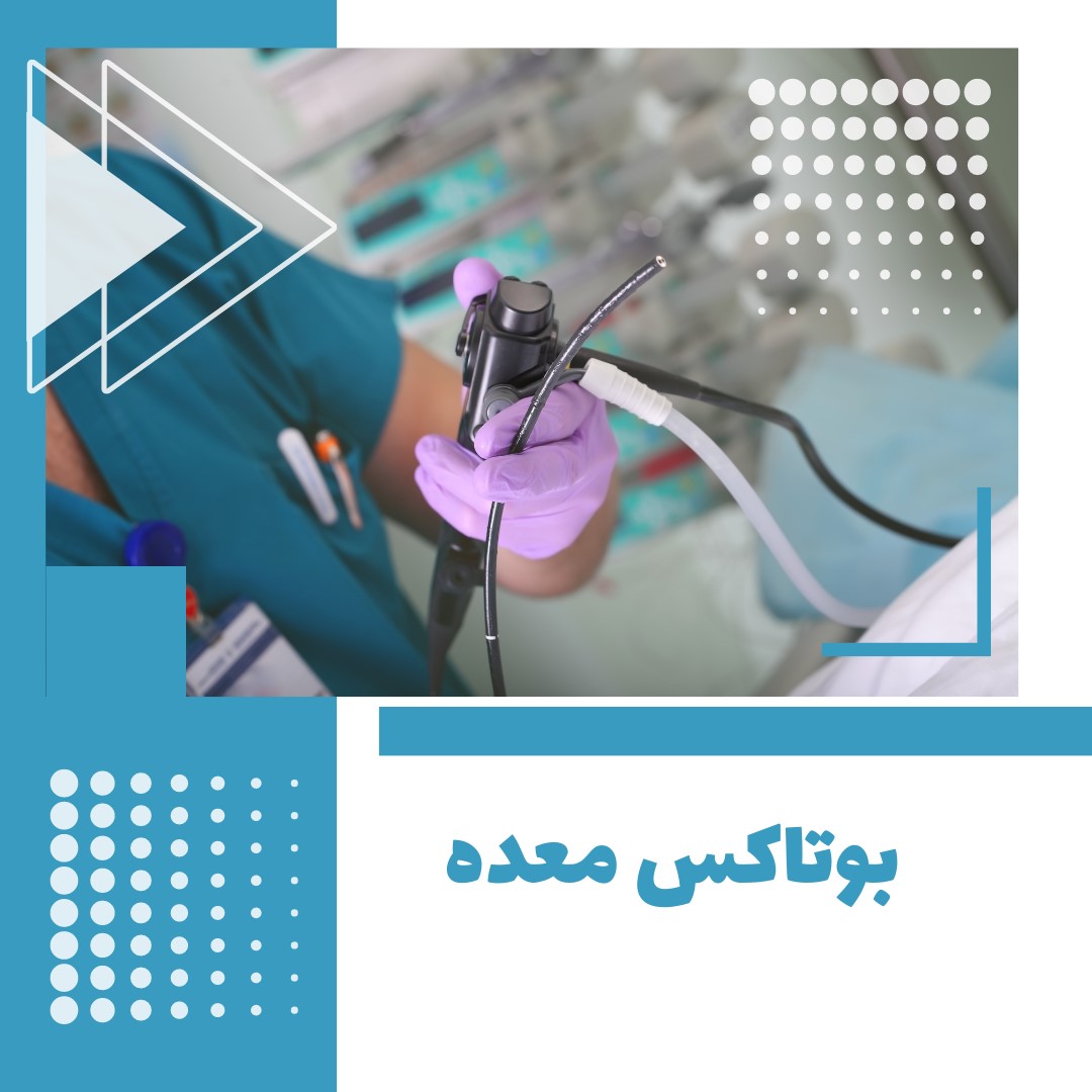 بوتاکس معده