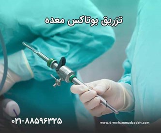 تزریق بوتاکس معده برای لاغری در تهران