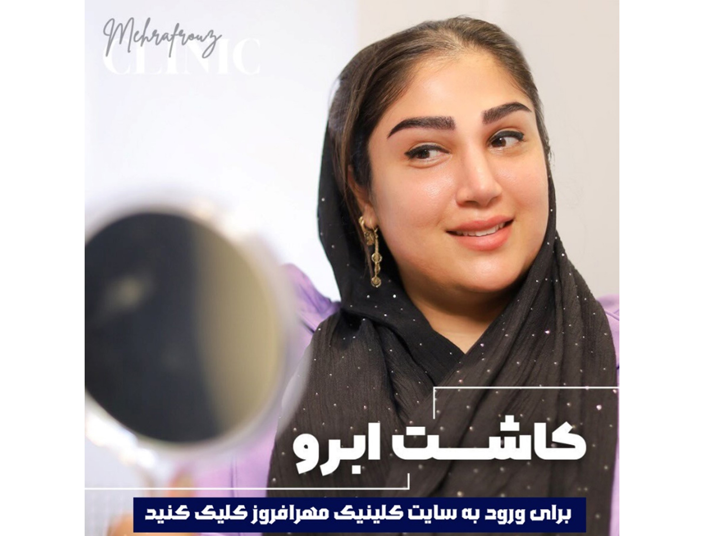 هزینه کاشت ابرو