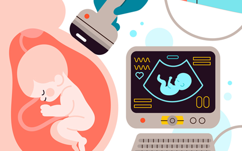 سونوگرافی در بارداری