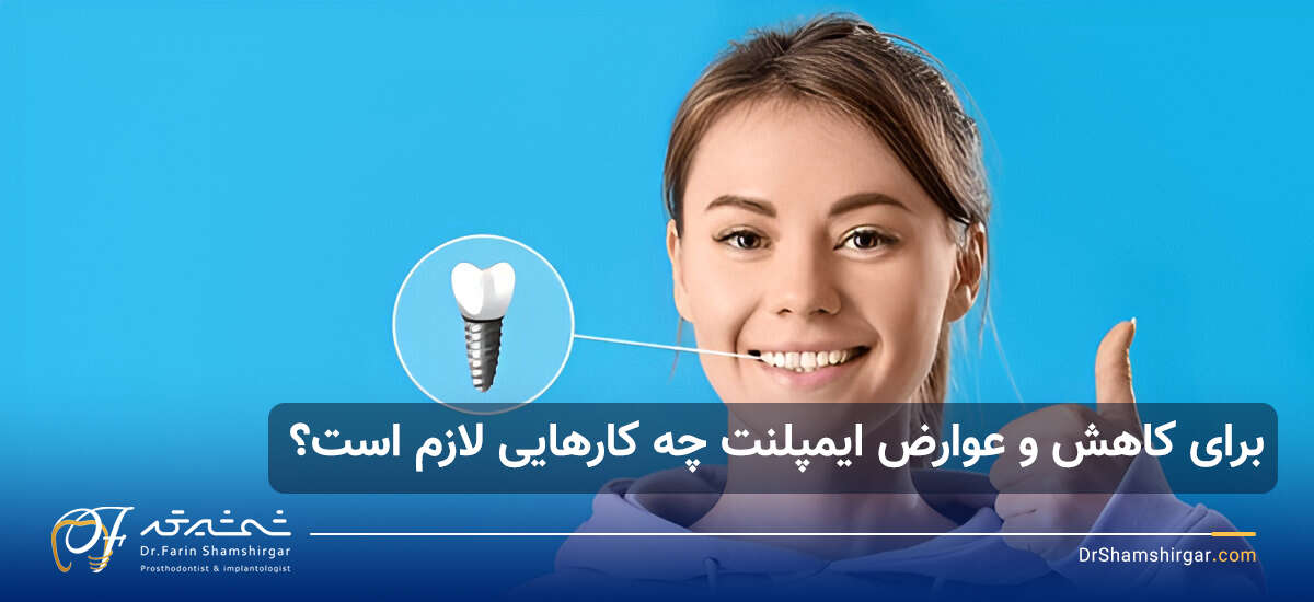 متخصص ایمپلنت دندان در زعفرانیه