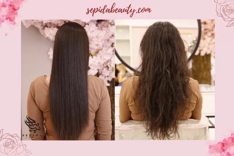 قیمت بوتاکس مو-سپیدار بیوتی