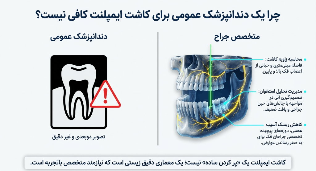 مقایسه متخصص جراح و پزشک عمومی برای انجام ایمپلنت