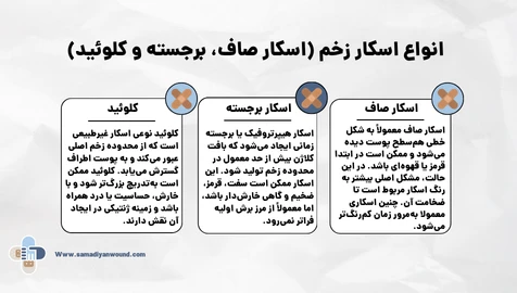 انواع اسکار
