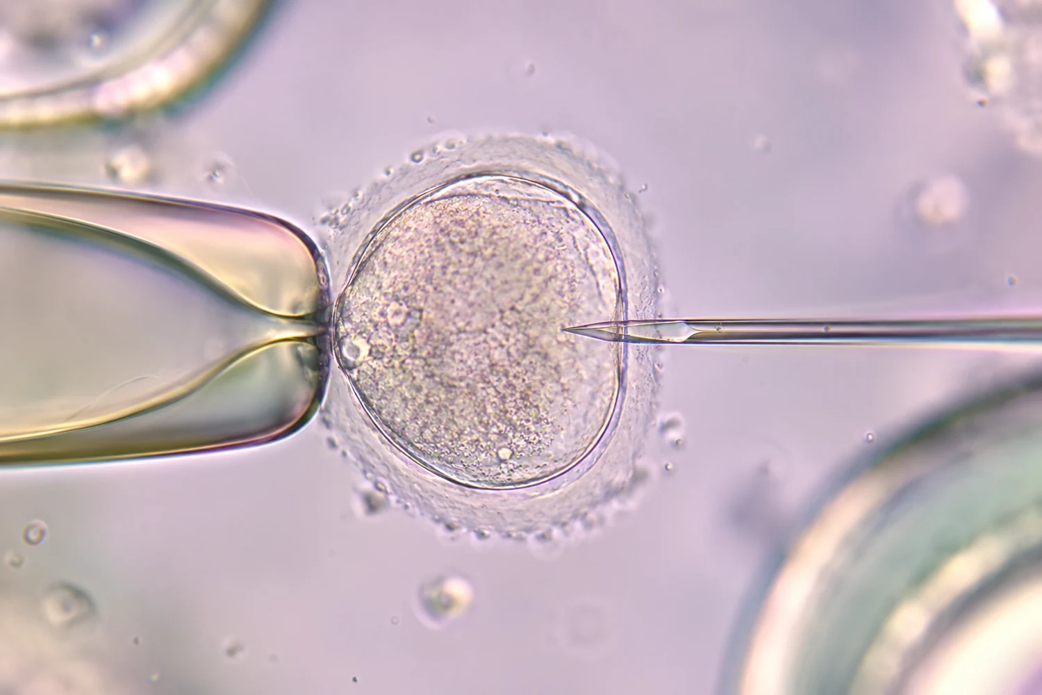 آزمایشگاه لقاح آزمایشگاهی یا IVF