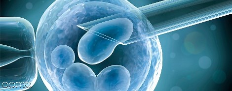 ivf چگونه انجام میشود ivf چگونه انجام میشود