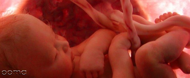 شکل جنین در سه ماهگی شکل جنین در سه ماهگی