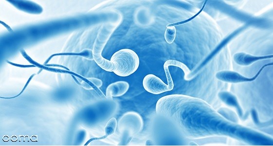 آزمایش اسپرم چگونه است؟ آزمایش اسپرم چگونه است؟