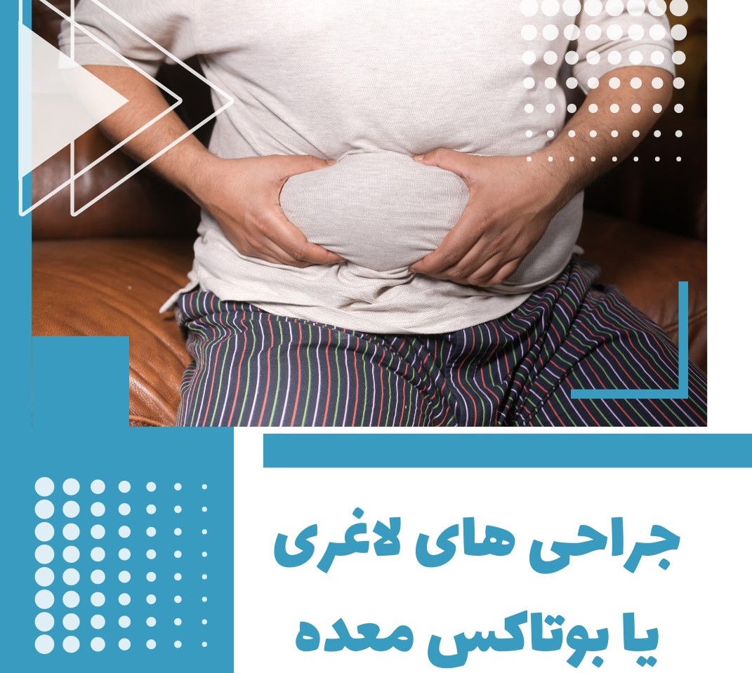 بوتاکس معده یا جراحی لاغری بوتاکس معده یا جراحی لاغری