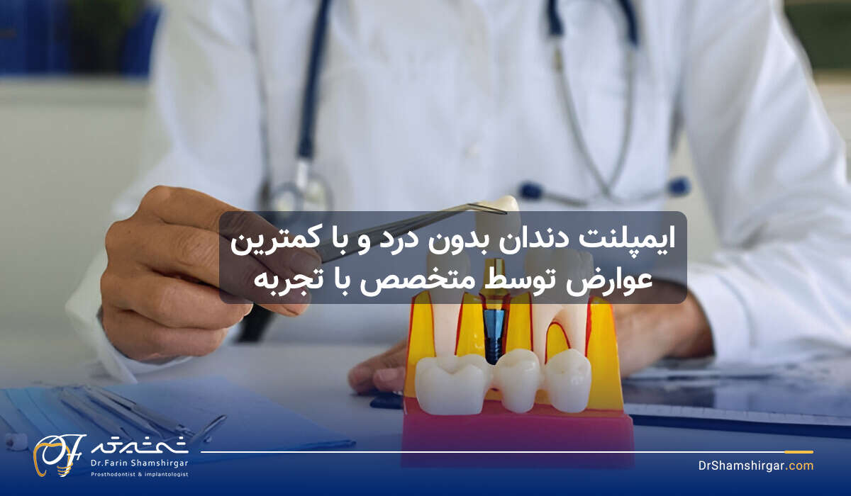ایمپلنت دندان بدون درد و با کمترین عوارض توسط متخصص باتجربه ایمپلنت دندان بدون درد و با کمترین عوارض توسط متخصص باتجربه