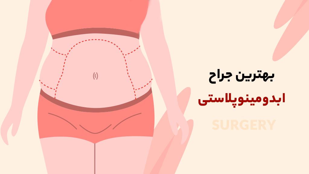 بهترین جراح ابدومینوپلاستی در شیراز (هزینه + مراقبت ها) بهترین جراح ابدومینوپلاستی در شیراز (هزینه + مراقبت ها)