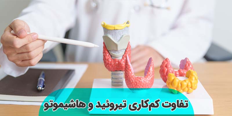 تفاوت کم کاری تیروئید و هاشیموتو تفاوت کم کاری تیروئید و هاشیموتو