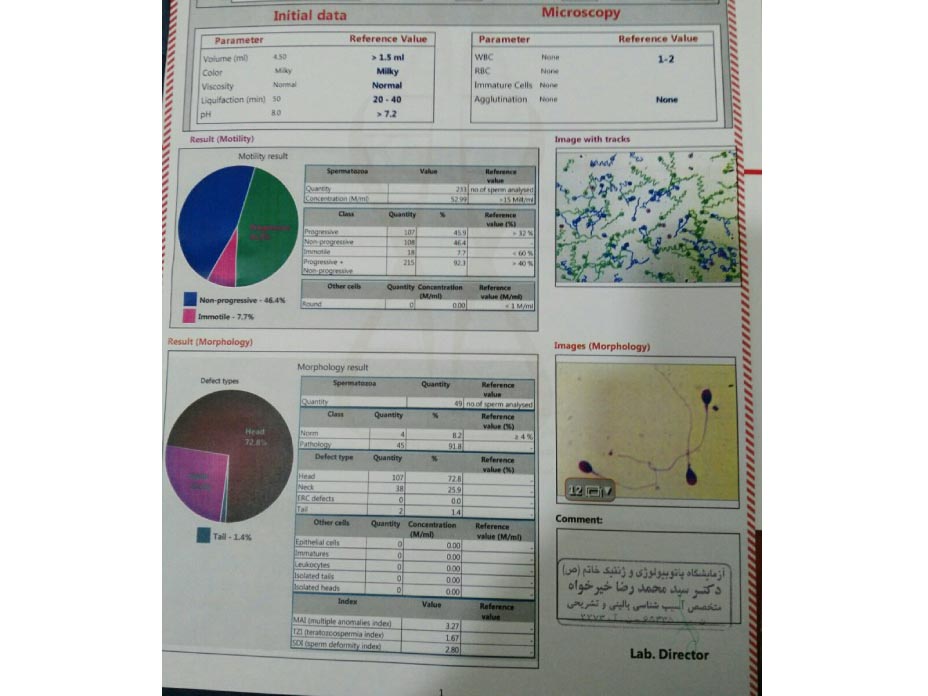 معنی Progressive در آزمایش اسپرم چیست؟ معنی Progressive در آزمایش اسپرم چیست؟