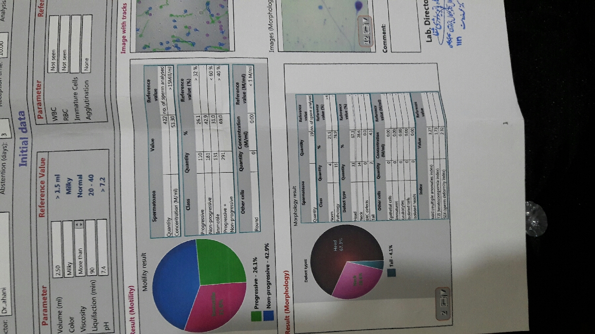 تفسیر ازمایش اسپرم