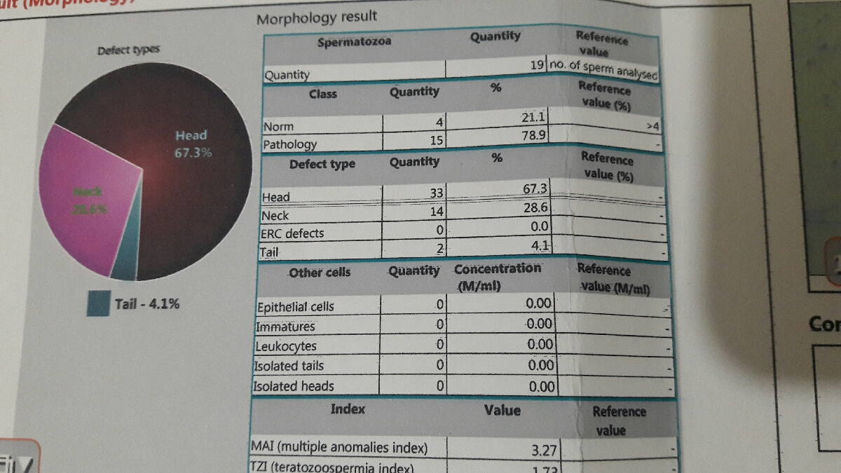 تفسیر ازمایش اسپرم