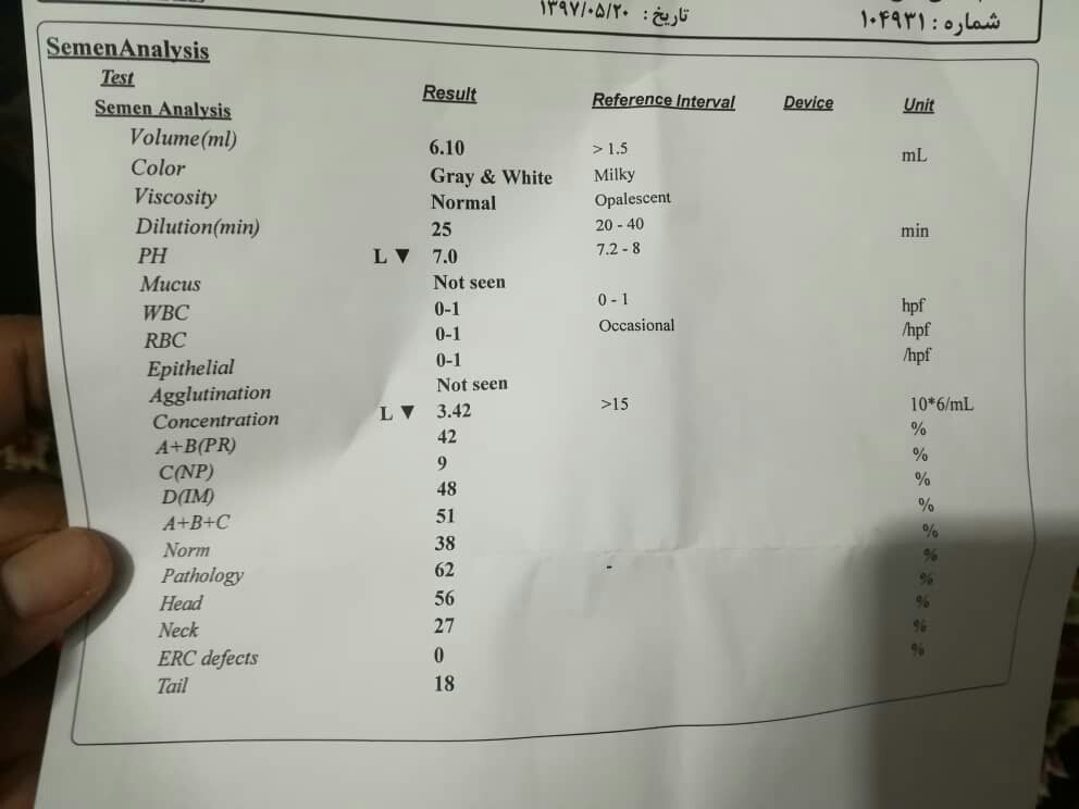 تفسیر آزمایش اسپرم