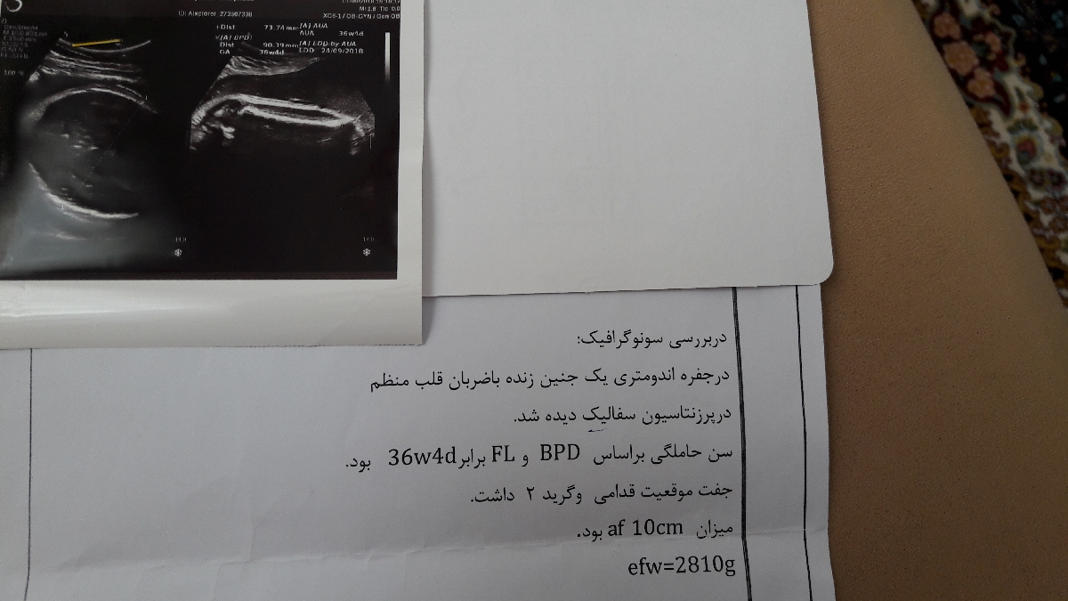 سن جنین و اندازه دور سر بچه براساس سونگرافی